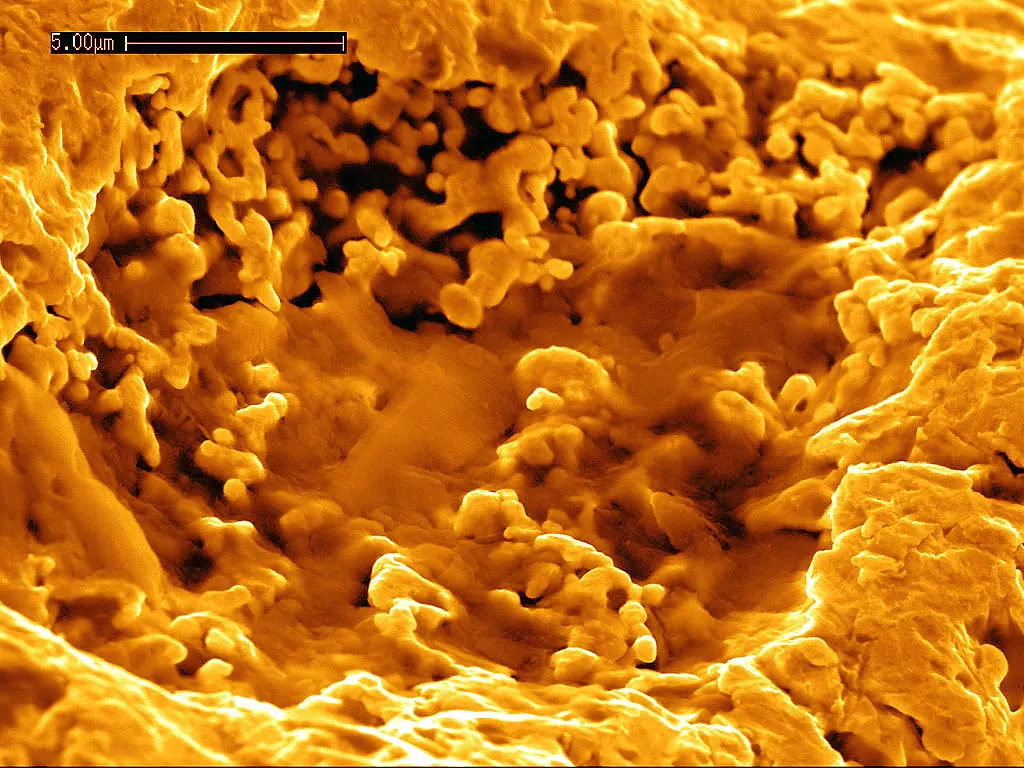 Image colorisée au microscope électronique d'un grain d'or couvert de formes semblables à des bactéries.