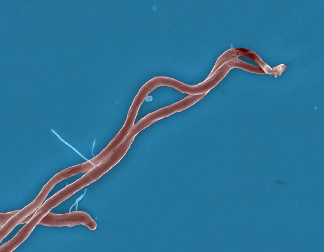 Micrographie électronique colorisée de bactéries Borrelia burgdorferi, de longs filaments ondulés rouge-brun sur fond bleu.